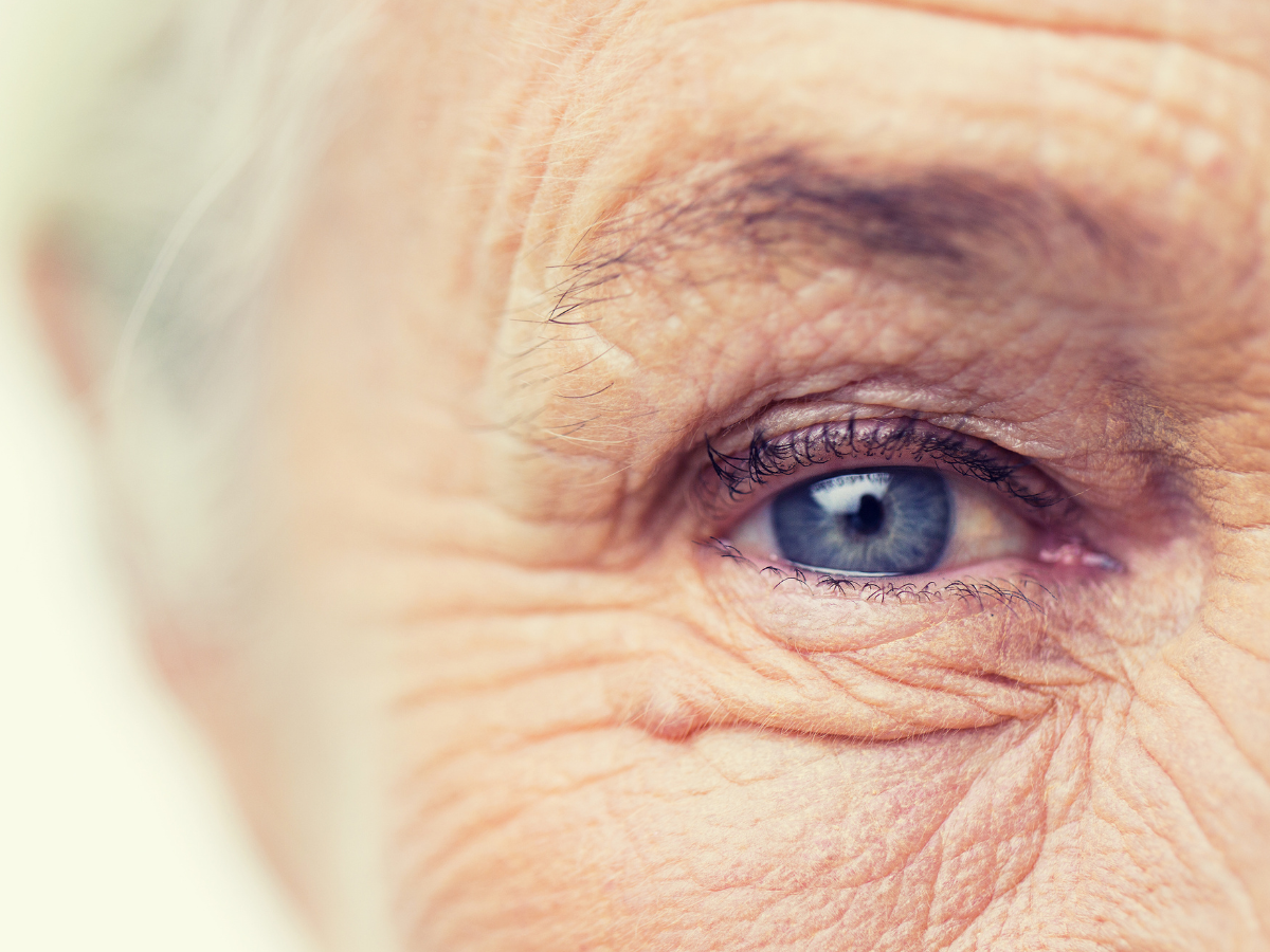 Células Zumbis no envelhecimento da pele. Foto aparece um rosto de idoso com rugas aparentes e de olho azul.